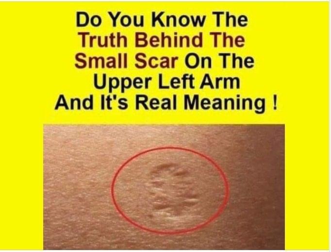 Do You Know The Real Significance Of The Small Scar