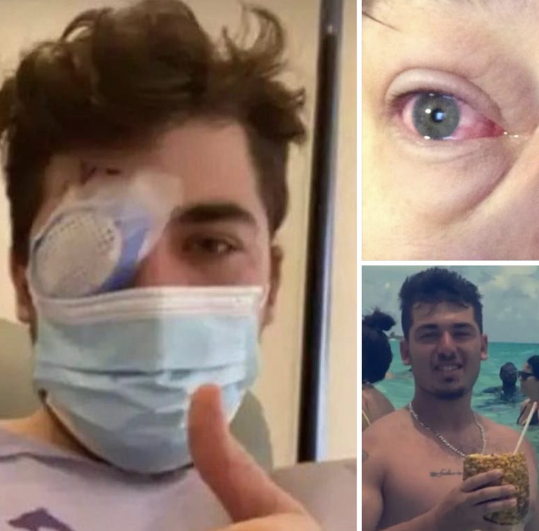 Man goes blind after sleeping with contact lenses, experts warn of irreversible damage