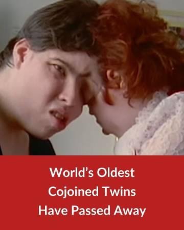 Lori and George Schappell: Oldest Cojoined Twins Die At 62