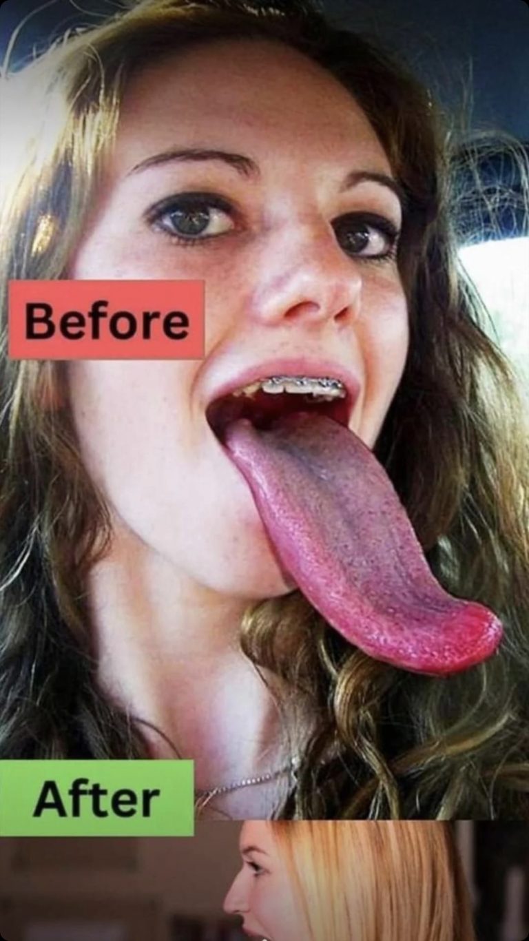 Fun Facts About The Tongue