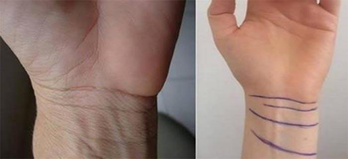 The Number Of Lines On Your Wrist Means A Lot More Than You’d Think, Do You Have 3 or 4?