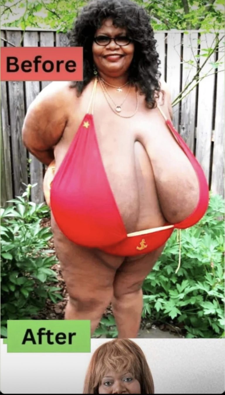 EVERY DAY I AM TAUNTED BY STRANGERS’: WOMAN WITH WORLD’S LARGEST NATURAL BREASTS ON BULLYING SHE HAS SUFFERED