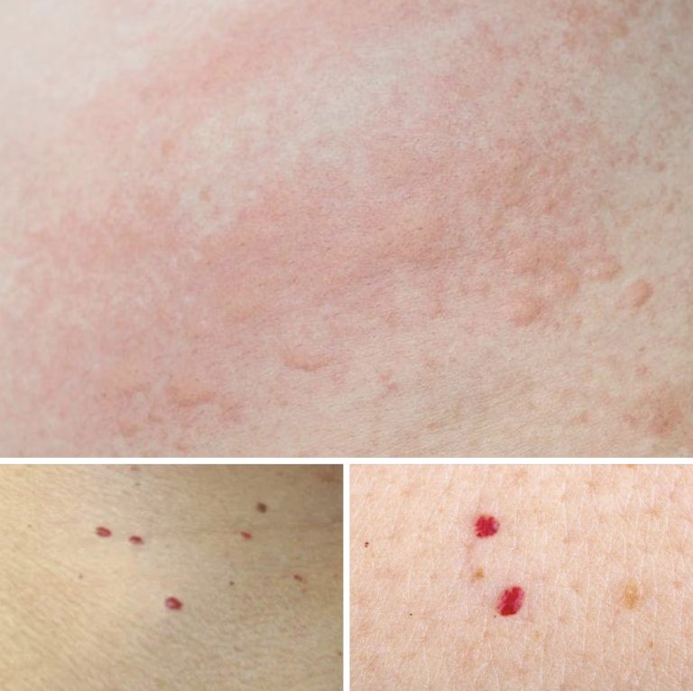 Red Dots on Your Skin: Causes and What They Could Mean