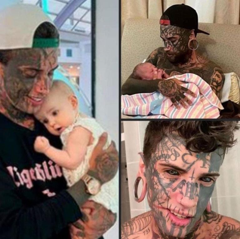 A 24-year-old father, who has several tattoos all over his body, makes the decision to get them erased for his child