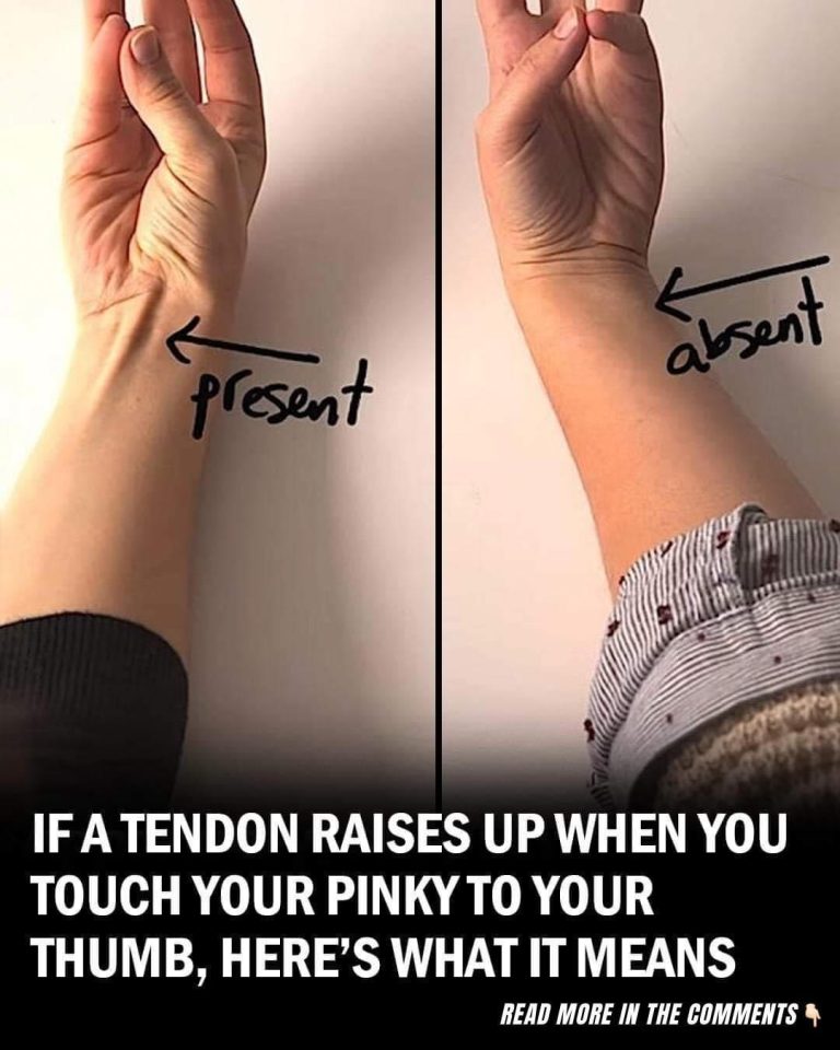 The Surprising Link Between Your Tendon and Evolution