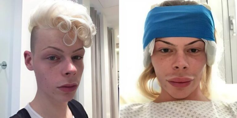 The Alteration During The Life: His $73000 Transformation Made People Think About The Boundaries Of Plastic Surgeries, Discover His Total Look After Operations  Source: https://very-interesting.com/his-73000-transformation