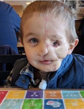 Boy, 5, survives savage attack by two