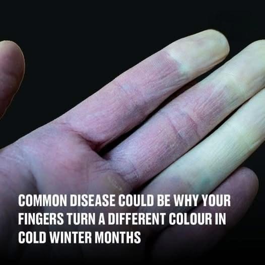 Common disease could be why