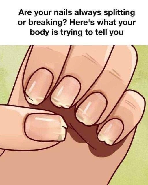 Are your nails always splitting or