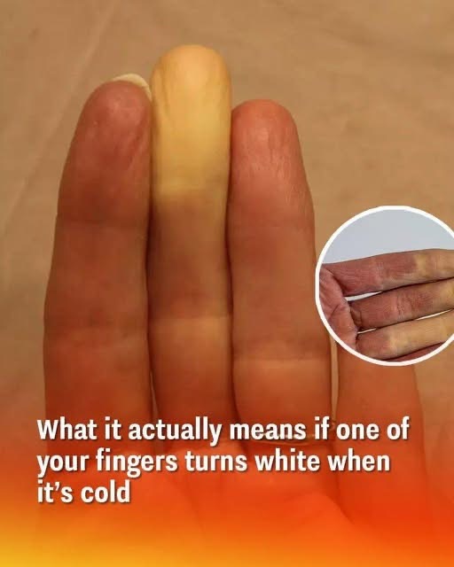 Your Fingertips May Change Color During