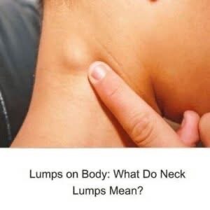 When to worry about neck lumps