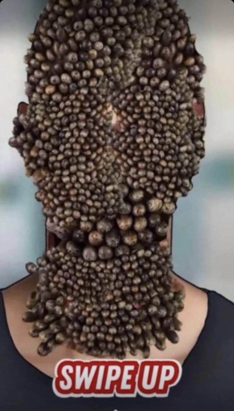 7 Tips to Get Rid of Body