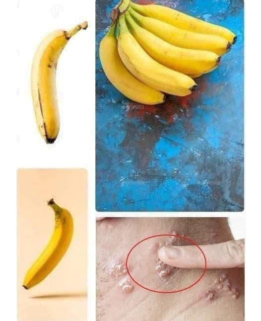 What Happens If You Eat a Banana Every