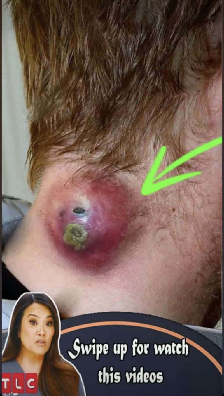 Seven Things That Clog Your Pores