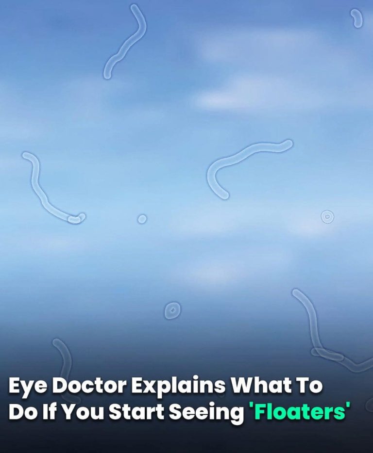 Eye Doctor Explains What To Do If You Start