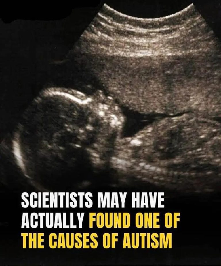 Study identifies possible connection to