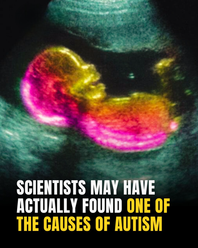 Study Suggests Key Link That Could