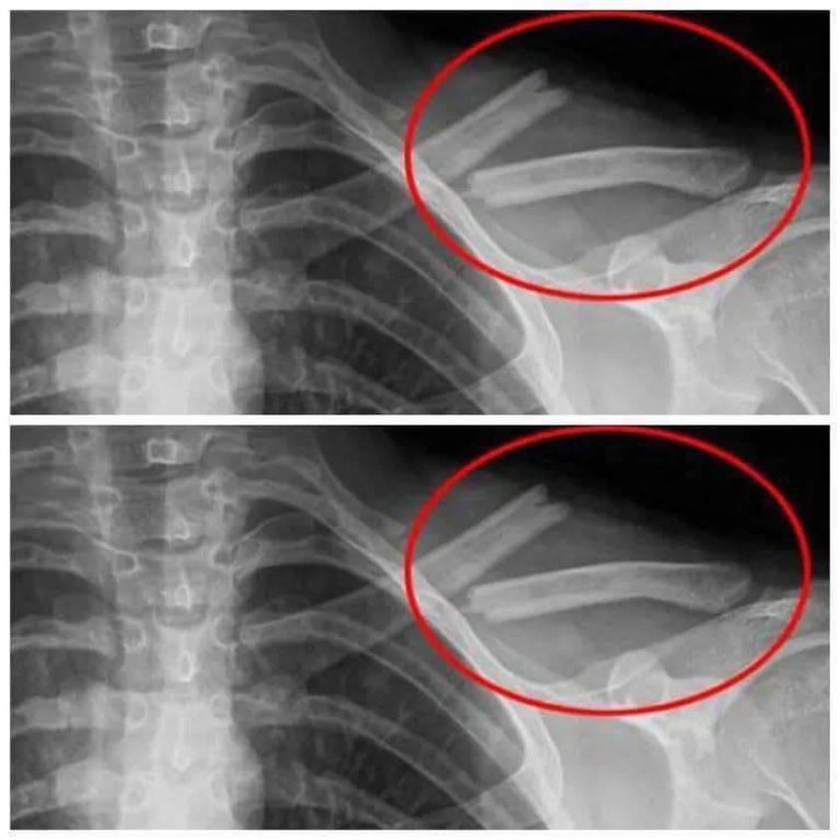 This Drink WiII Destroy Your Bones From The Inside But