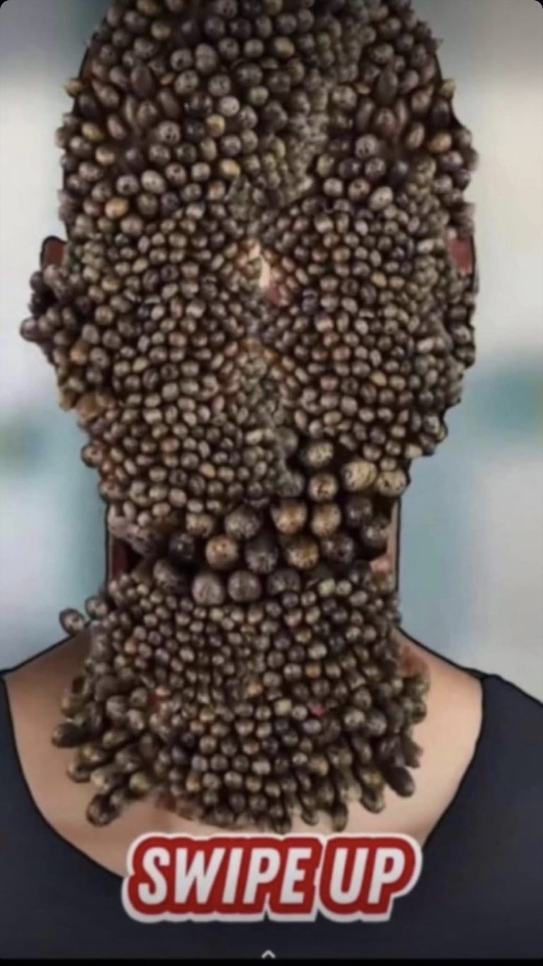 7 Tips to Get Rid of Body Acne