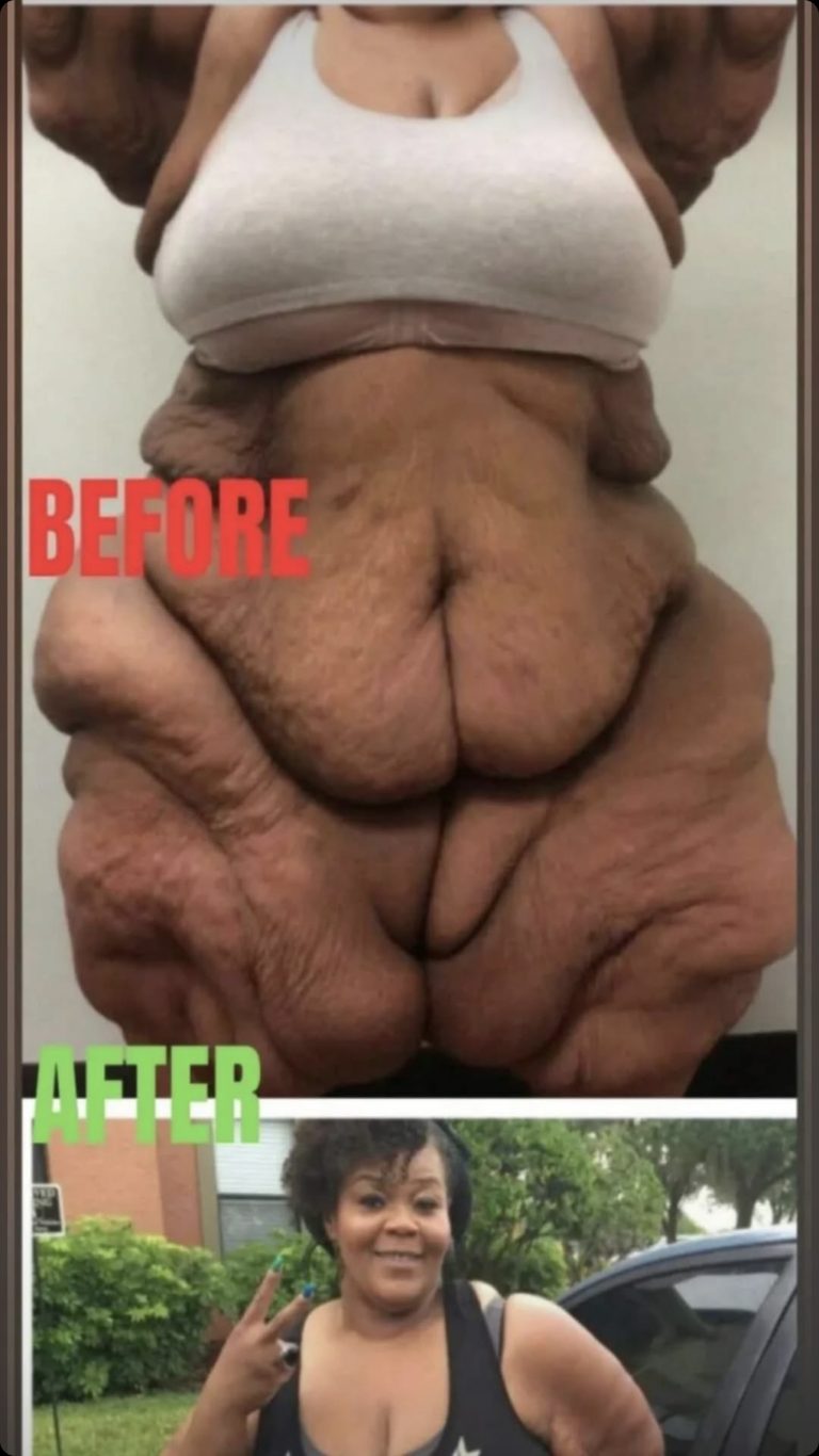 World’s heaviest woman who weighed