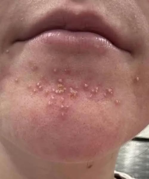 Be careful! These are the consequences of sleepi