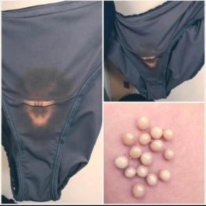 BE CAREFUL, if you notice this in your underwear,