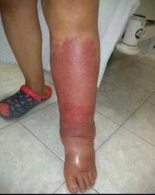 Signs on your FEET that indicate he i