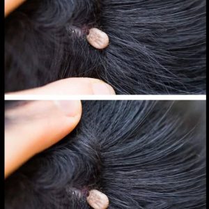 Just Discovered This In My Son’s Hair