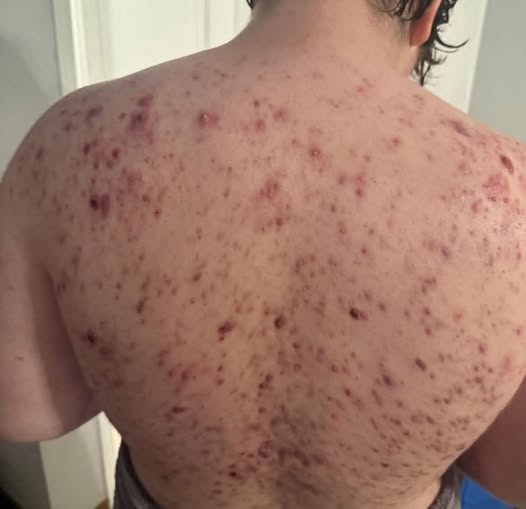 These are the consequences of sleeping with th