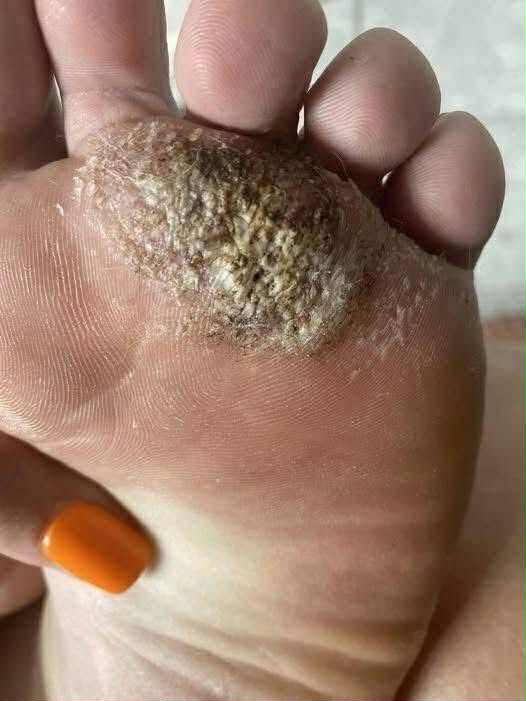 BE VERY CAREFUL . If you get this, you are infected with