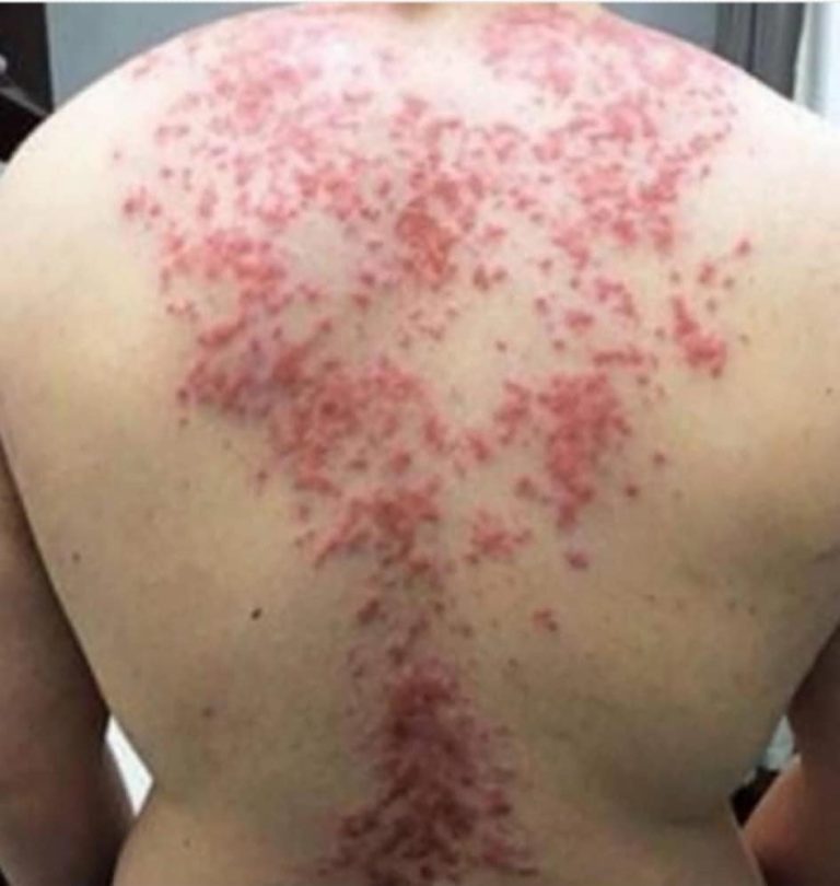 These are the consequences of sleeping with the…See more