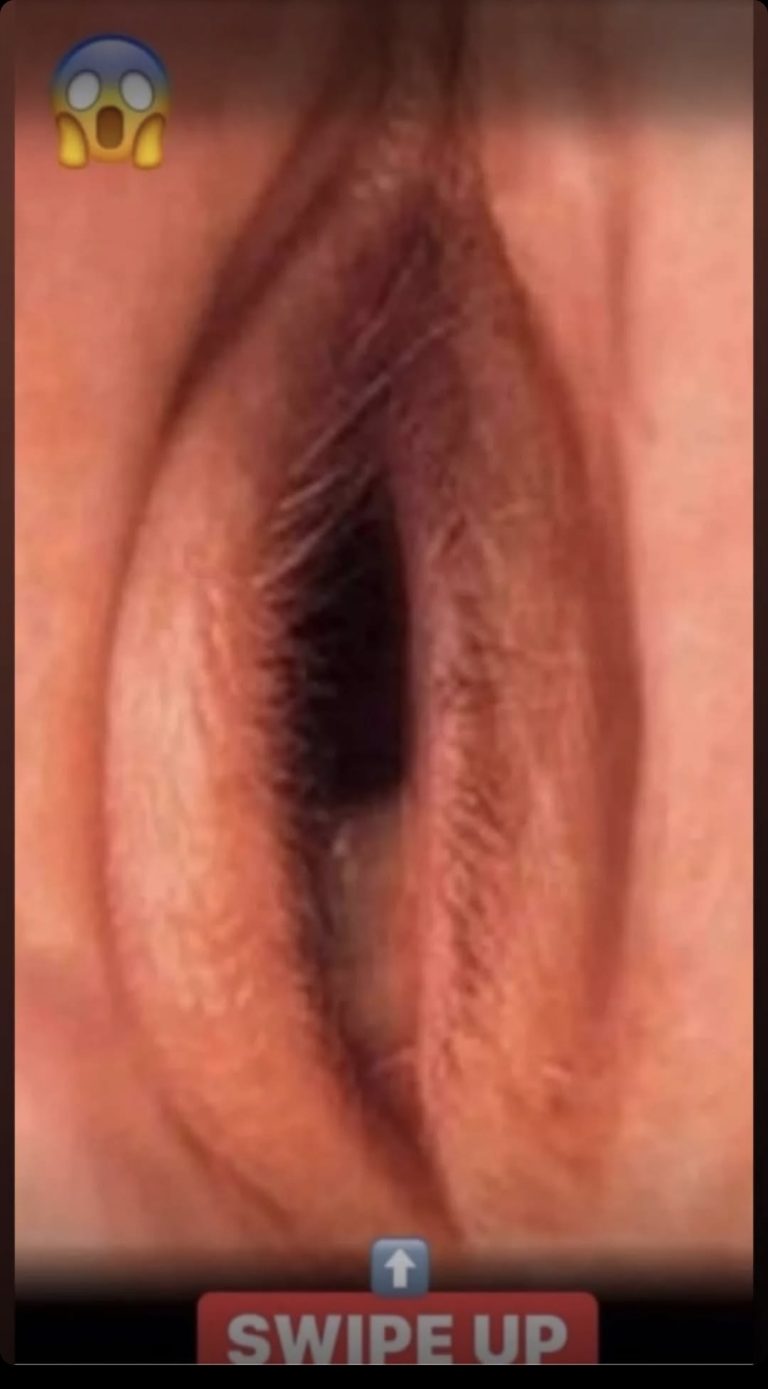 Skin Signals for Serious Illness Diagnosis