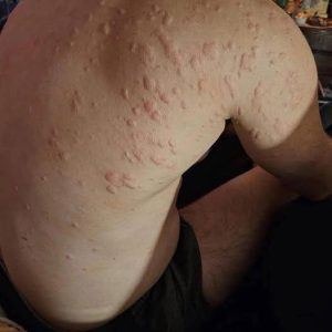 Unexpected Consequences of Sleeping with the Wrong