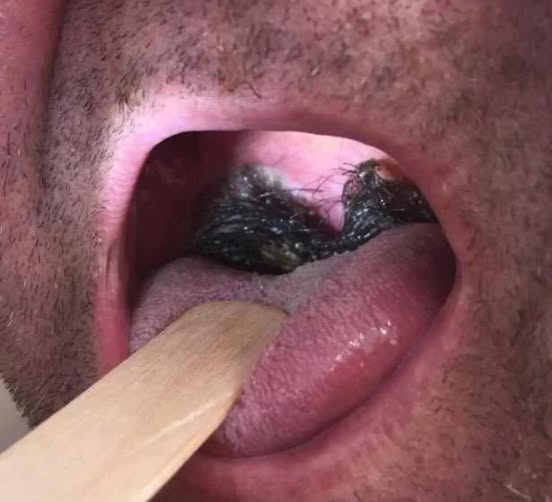 What No One Tells You About Intimacy wit