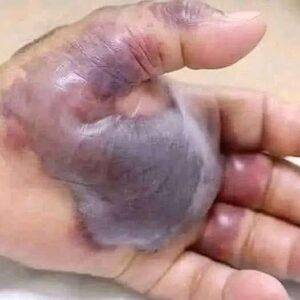 ATTENTION to these first signs of