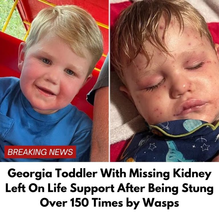 Georgia toddler stung over 150 time