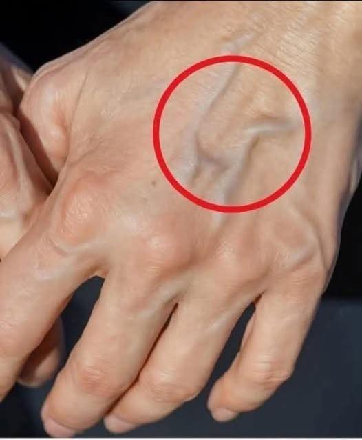 Why are your veins suddenly bulging and visible?