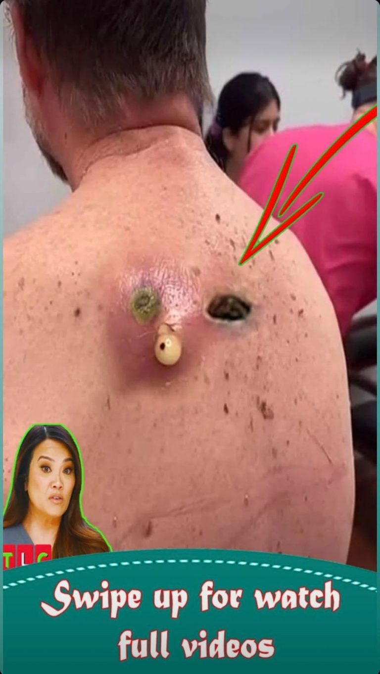 How Skin Texture Changes Reveal Hor