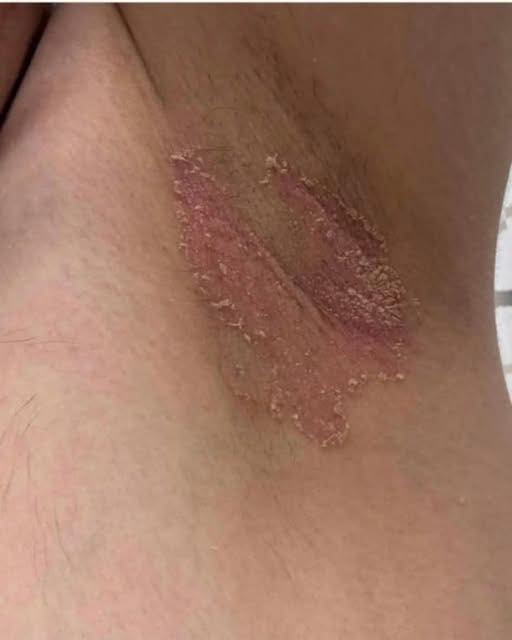 These are the first symptoms of c