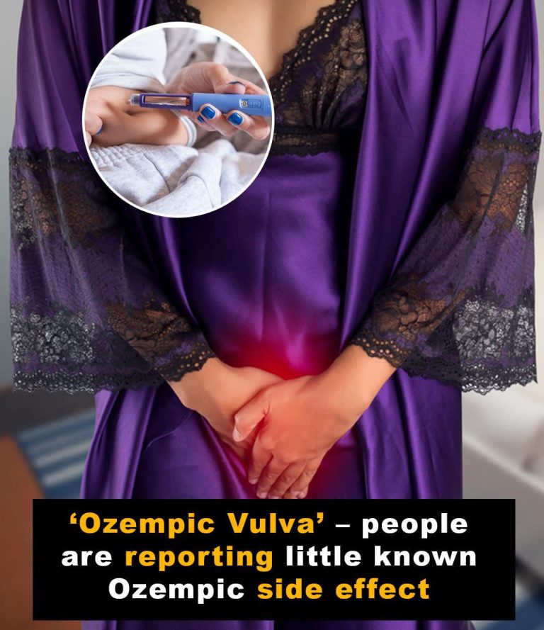 Women share Ozempic side effect known as ‘o