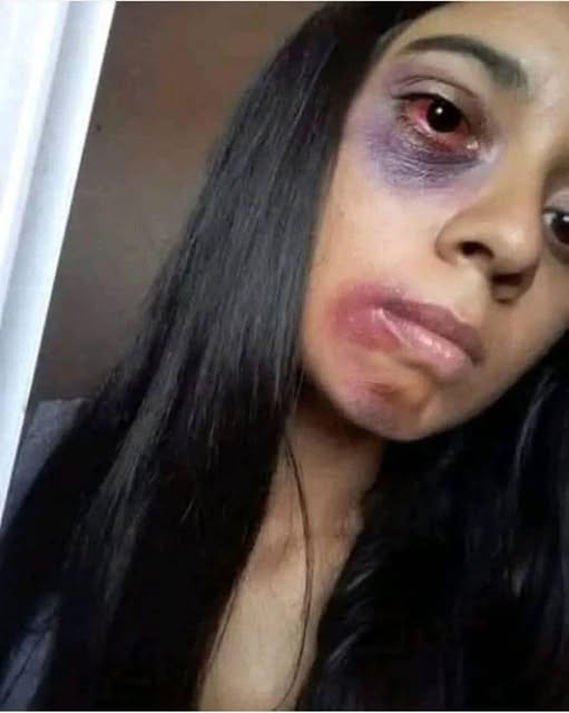 RIP Young woman d!es at the hands of her