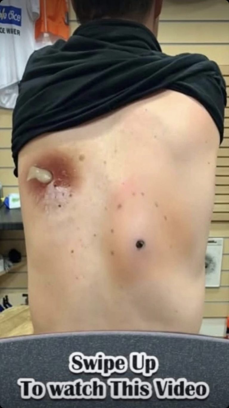 Early Signs of Health Problems Yo