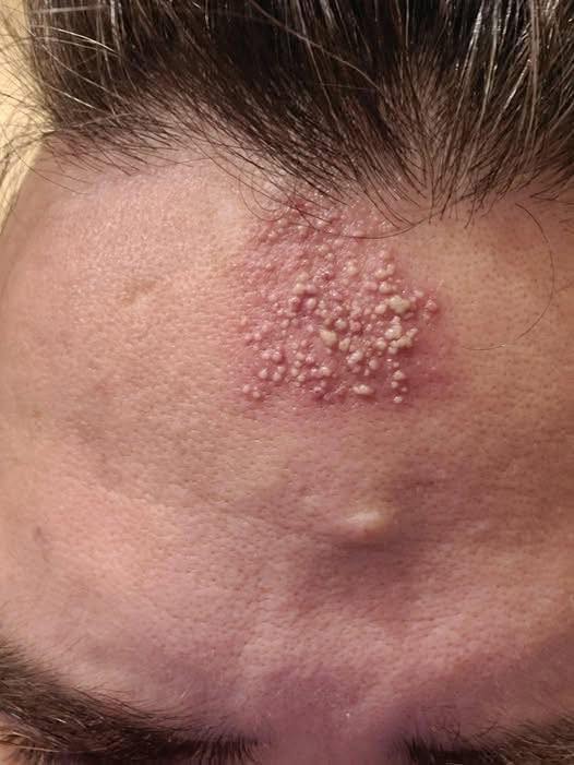 These are the consequences of sleeping with…