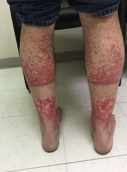 The Hidden Consequences of Sle