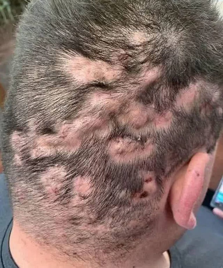 Early warning signs: signs that your hea