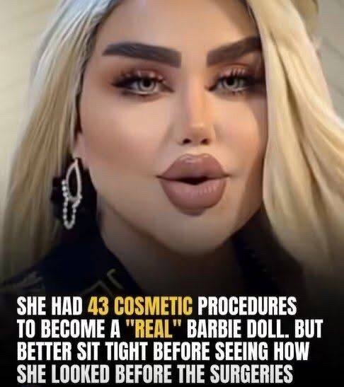 43 Surgeries to Look Like a Doll Spark Cont