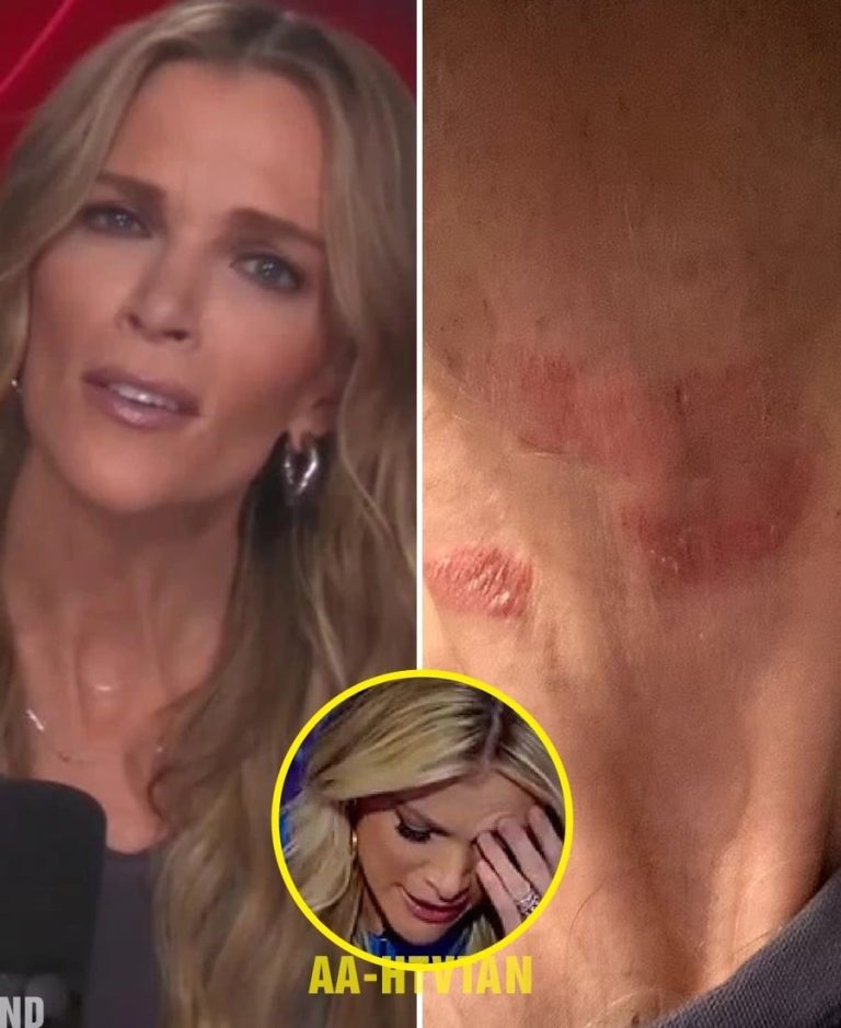 Megyn Kelly Hospitalized in Critical C