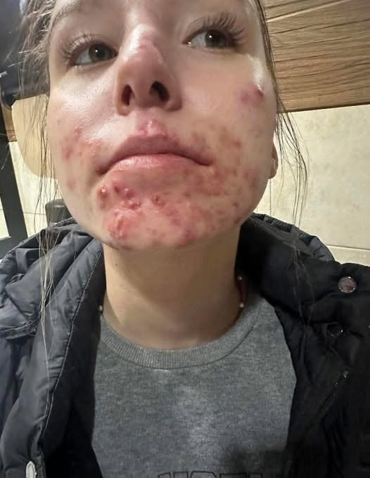 His body was itchy, he thought