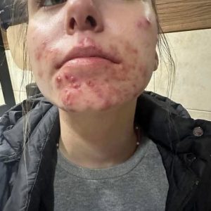 He Thought It Was Allergy – Truth Shocked