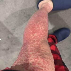 These are the consequences of sleeping with